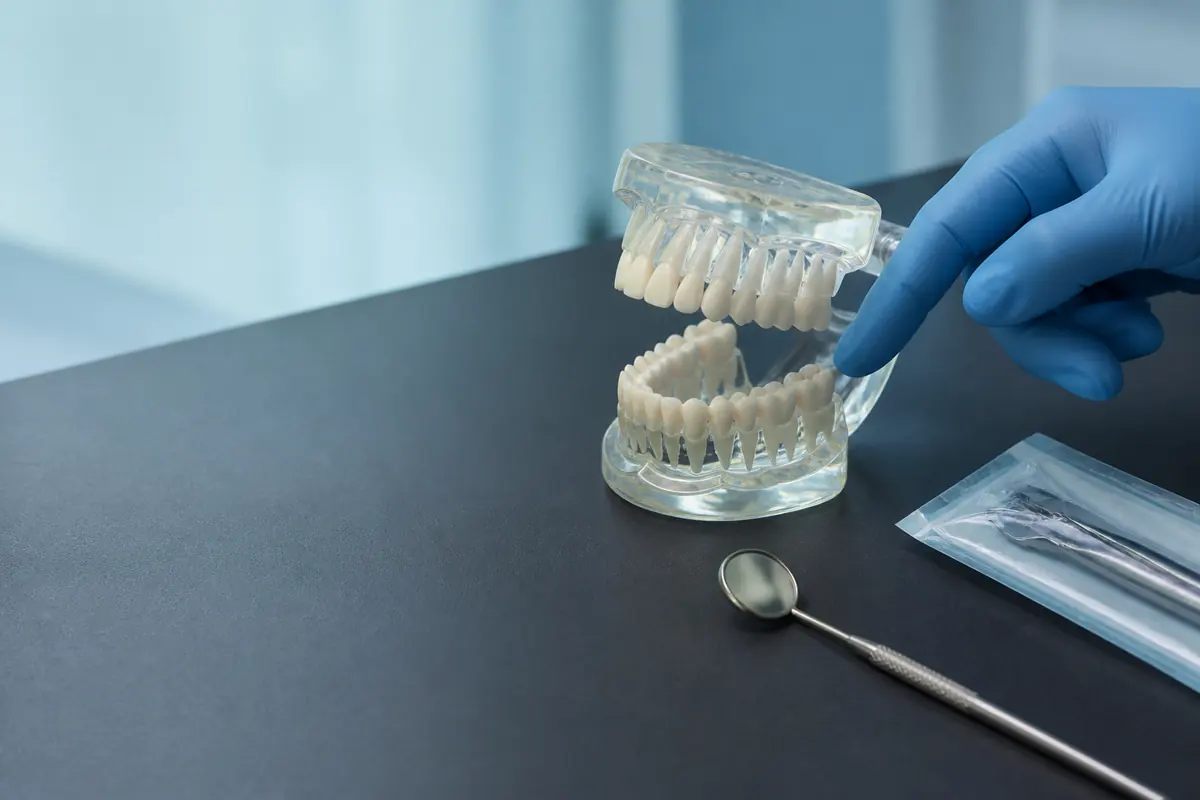 Modelo anatómico de la dentición durante una valoración previa de cirugía oral.