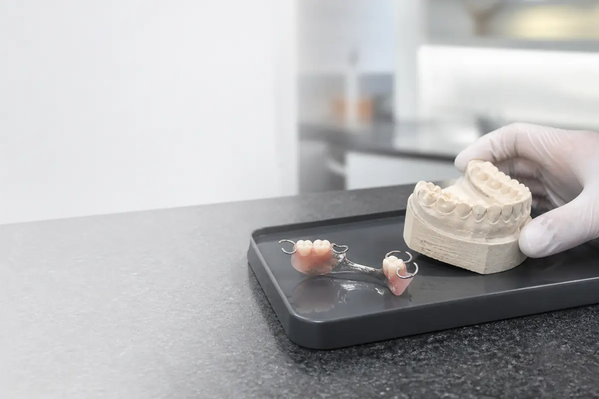 Prótesis dental removible junto a un modelo de estudio.